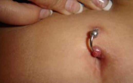 Infected Pussy Tube 62