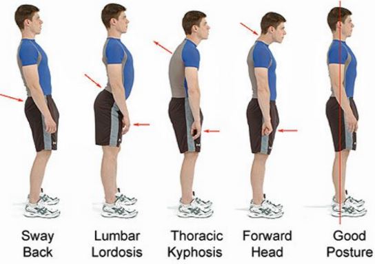 Poor posture can also cause shoulder pain