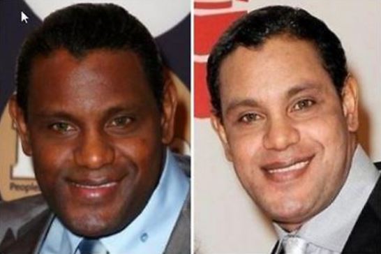 Male celebrities have also done laser skin lightening plastic surgery